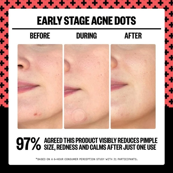 PEACE OUT | Early Stage Acne Dot - 8 acne treatment dots - Picture 4 of 11